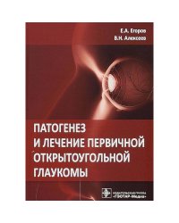 Патогенез и лечение первичной открытоугольной глаукомы