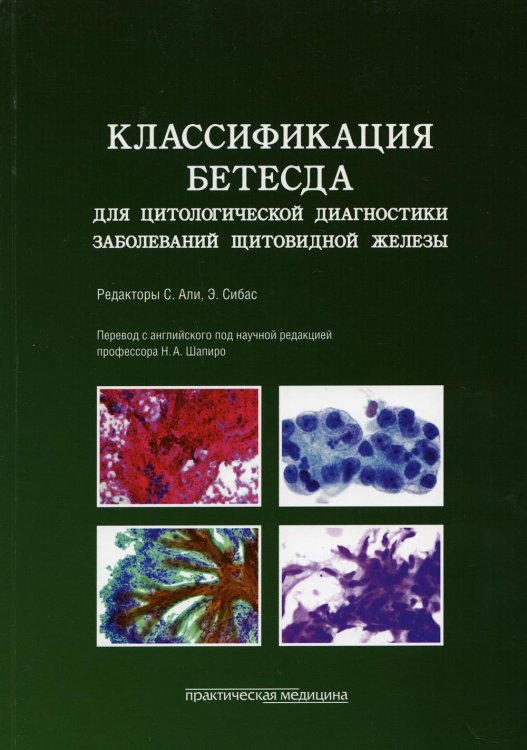 Классификация Бетесда для цитологической диагностики заболеваний щитовидной железы. Терминология