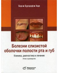 Болезни слизистой оболочки полости рта и губ. Клиника, диагностика и лечение