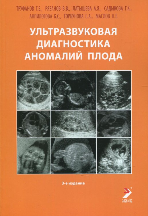 Ультразвуковая диагностика аномалий плода. Руководство для врачей