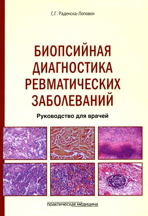 Биопсийная диагностика ревматических заболеваний. Руководство для врачей