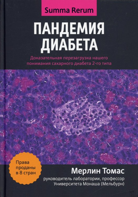 Пандемия диабета. Доказательная перезагрузка нашего понимания сахарного диабета 2-го типа