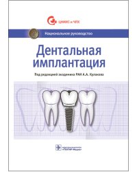 Дентальная имплантация: национальное руководство