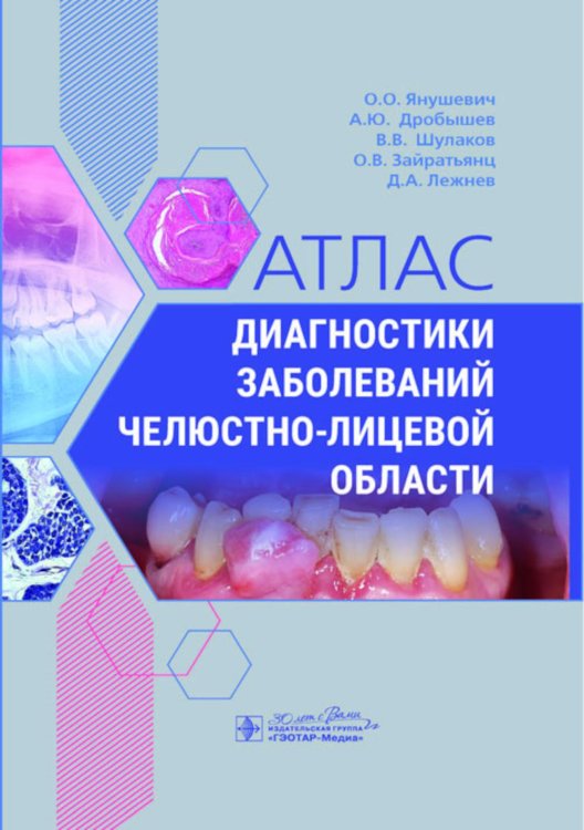 Атлас диагностики заболеваний челюстно-лицевой области