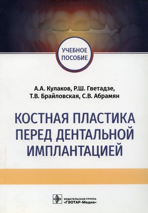 Костная пластика перед дентальной имплантацией. Учебное пособие