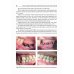 Костная пластика перед дентальной имплантацией. Учебное пособие