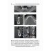 Костная пластика перед дентальной имплантацией. Учебное пособие
