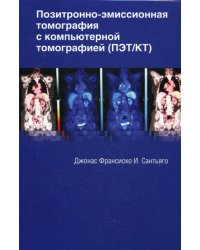 Позитронно-эмиссионная томография с компьютерной томографией (ПЭТ/КТ)