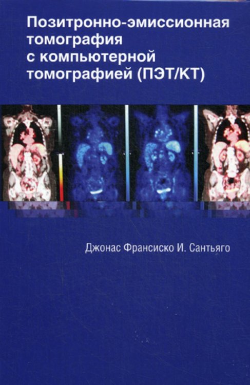 Позитронно-эмиссионная томография с компьютерной томографией (ПЭТ/КТ)