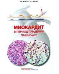 Миокардит в период пандемии SARS-CoV-2