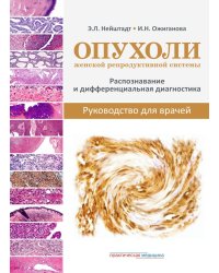 Опухоли женской репродуктивной системы. Распознавание и дифференциальная диагностика. Руководство для врачей