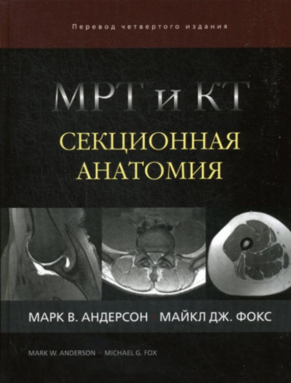 МРТ и КТ. Секционная анатомия