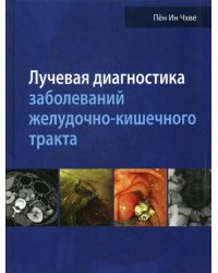 Лучевая диагностика заболеваний желудочно-кишечного тракта