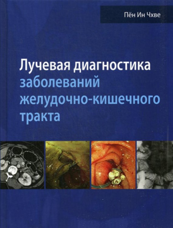 Лучевая диагностика заболеваний желудочно-кишечного тракта