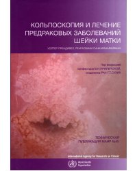 Кольпоскопия и лечение предраковых заболеваний шейки матки