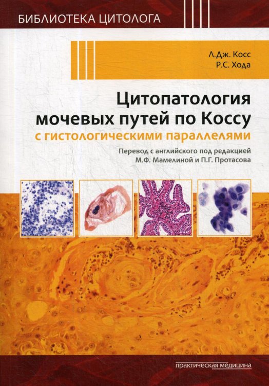 Цитопатология мочевых путей по Коссу с гистологическими параллелями