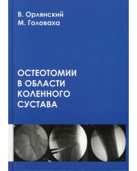 Остеотомии в области коленного сустава