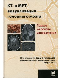 КТ- и МРТ- визуализация головного мозга. Подход на основе изображений. 2-е изд