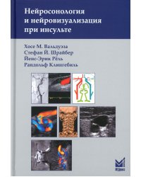 Нейросонология и нейровизуализация при инсульте. 3-е изд