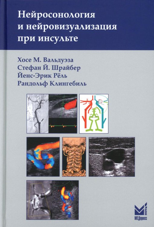 Нейросонология и нейровизуализация при инсульте. 3-е изд