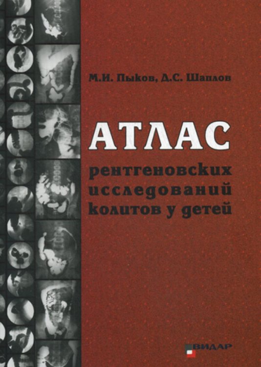 Атлас рентгеновских исследований колитов у детей. Учебное пособие