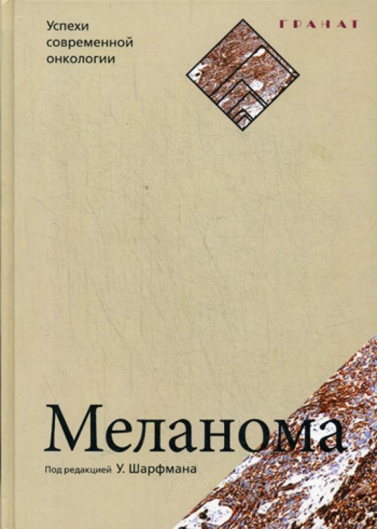 Меланома