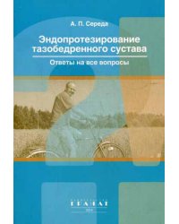 Эндопротезирование тазобедренного сустава: ответы на все вопросы