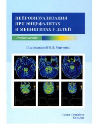 Нейровизуализация при энцефалитах и менингитах у детей