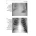 Клинико-рентгенологическая диагностика болезней органов дыхания. Общая врачебная практика