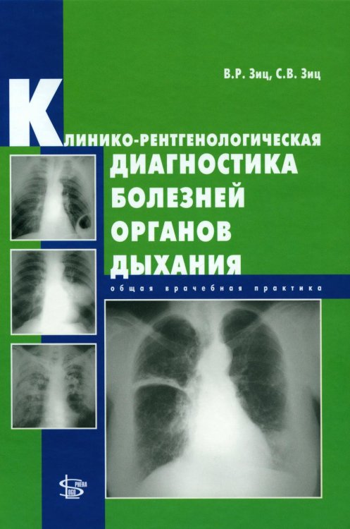 Клинико-рентгенологическая диагностика болезней органов дыхания. Общая врачебная практика