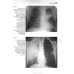 Клинико-рентгенологическая диагностика болезней органов дыхания. Общая врачебная практика