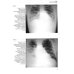 Клинико-рентгенологическая диагностика болезней органов дыхания. Общая врачебная практика