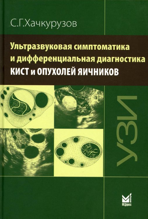 Ультразвуковая симптоматика и дифференциальная диагностика кист и опухолей яичников. 2-е изд