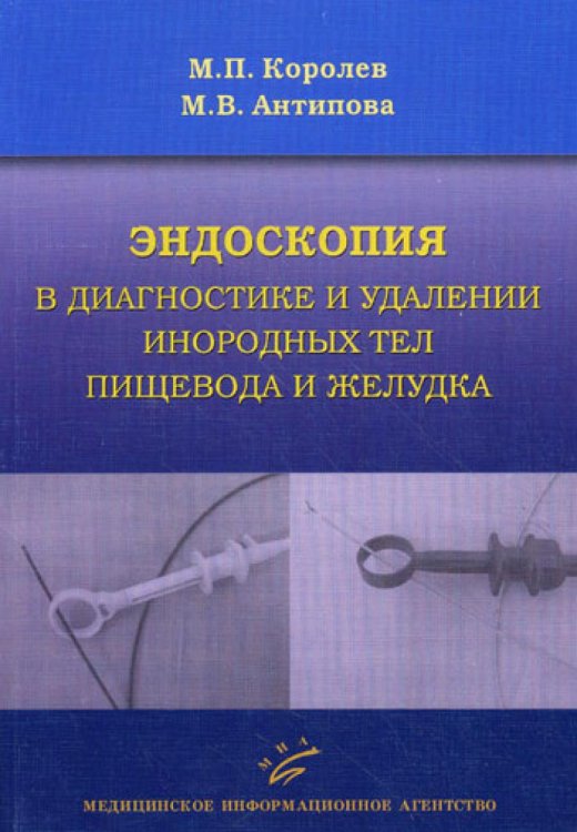 Эндоскопия в диагностике и удалении инородных тел пищевода и желудка / 