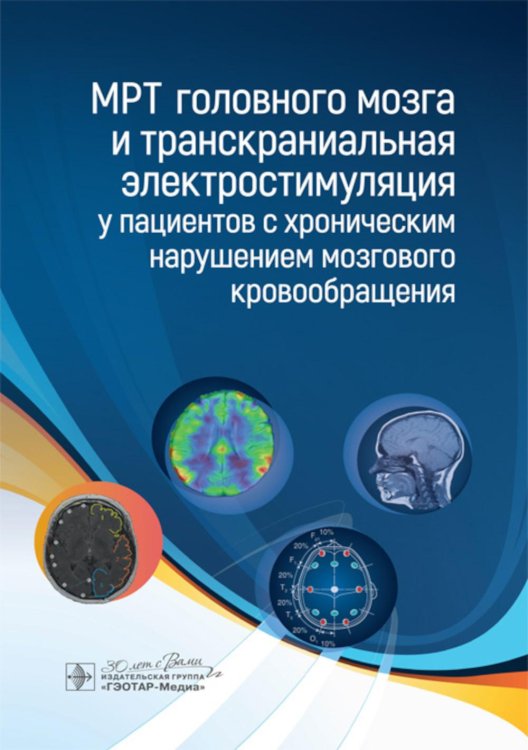 МРТ головного мозга и транскраниальная электростимуляция у пациентов с хроническим нарушением