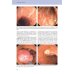 Практическая колоноскопия. Методика, рекомендации, советы и приемы. 3-е изд