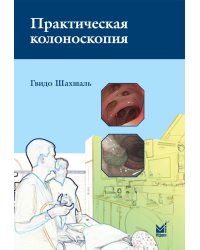 Практическая колоноскопия. Методика, рекомендации, советы и приемы. 3-е изд