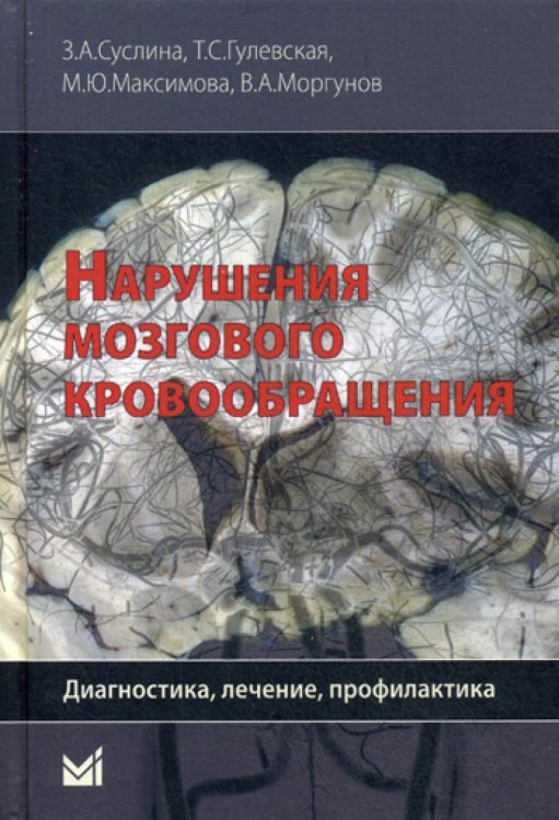 Нарушения мозгового кровообращения: диагностика, лечение, профилактика