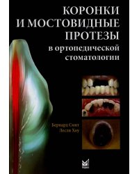 Коронки и мостовидные протезы в ортопедической стоматологии