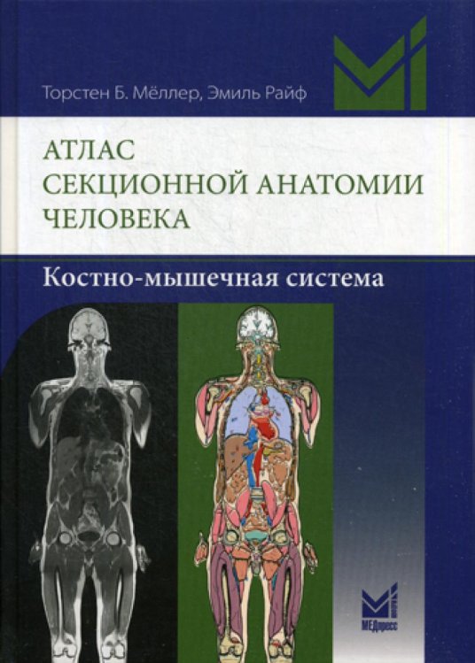 Атлас секционной анатомии человека. Костно-мышечная система