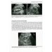 Ультразвуковое исследование в урологии и нефрологии: монография. 4-е изд., стер