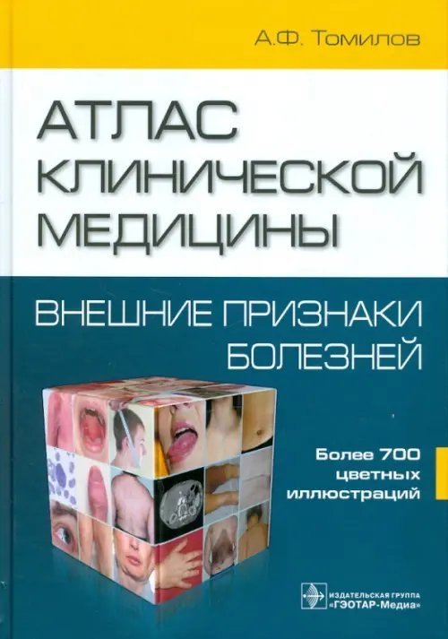 Атлас клинической медицины: Внешние признаки болезней