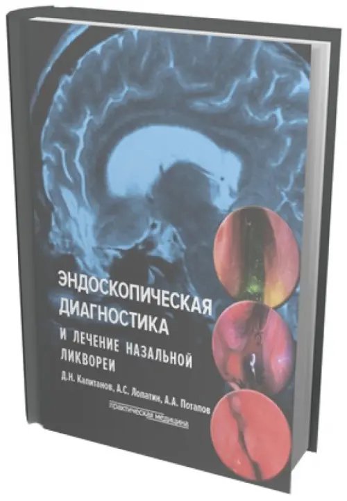 Эндоскопическая диагностика и лечение назальной ликвореи