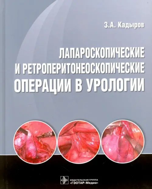 Лапароскопические и ретроперитонеоскопические операции в урологии