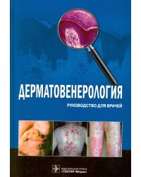 Дерматовенерология. Руководство для врачей