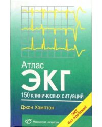 Атлас ЭКГ. 150 клинических ситуаций