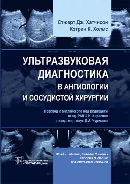 Ультразвуковая диагностика в ангиологии и сосудистой хирургии