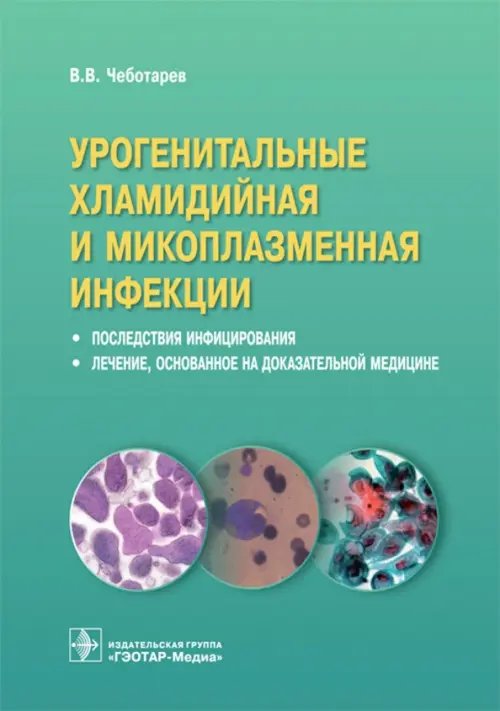 Урогенитальные хламидийная и микоплазменная инфекции.Последствия инфицирвания