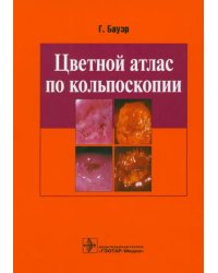 Цветной атлас по кольпоскопии