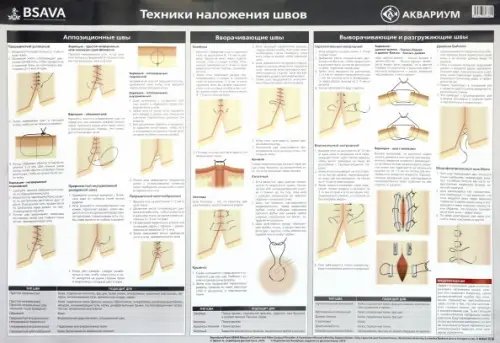 Плакат &quot;Техника наложения швов&quot; 84х59 см. (в тубусе)